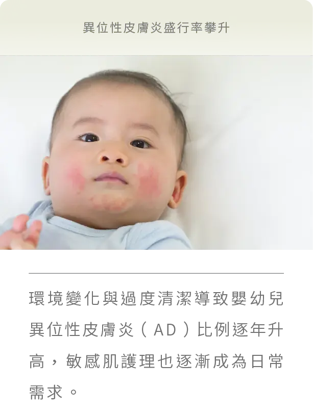 異位性皮膚炎盛行率攀升